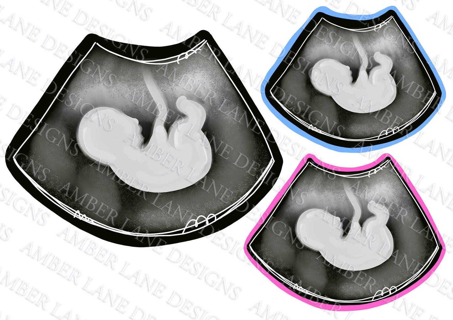 New Baby Ultrasound Sonogram 3 hand drawn png files
